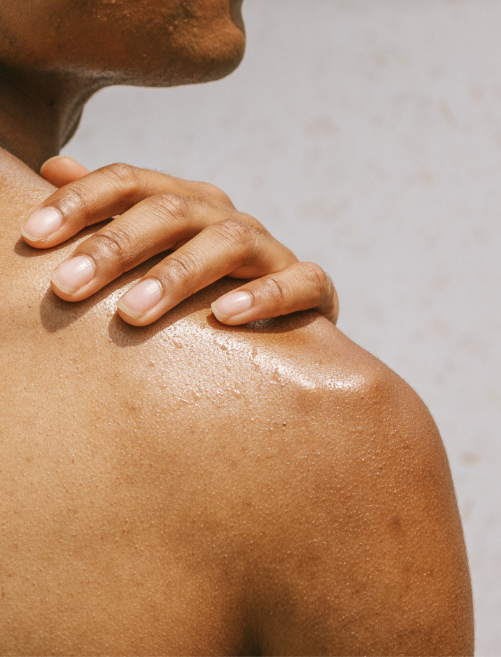 Hyperpigmentierung: Vitamin C Serum als schneller Retter