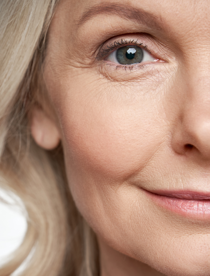 Kampf den Krähenfüßen: Aufgeben ist keine Option