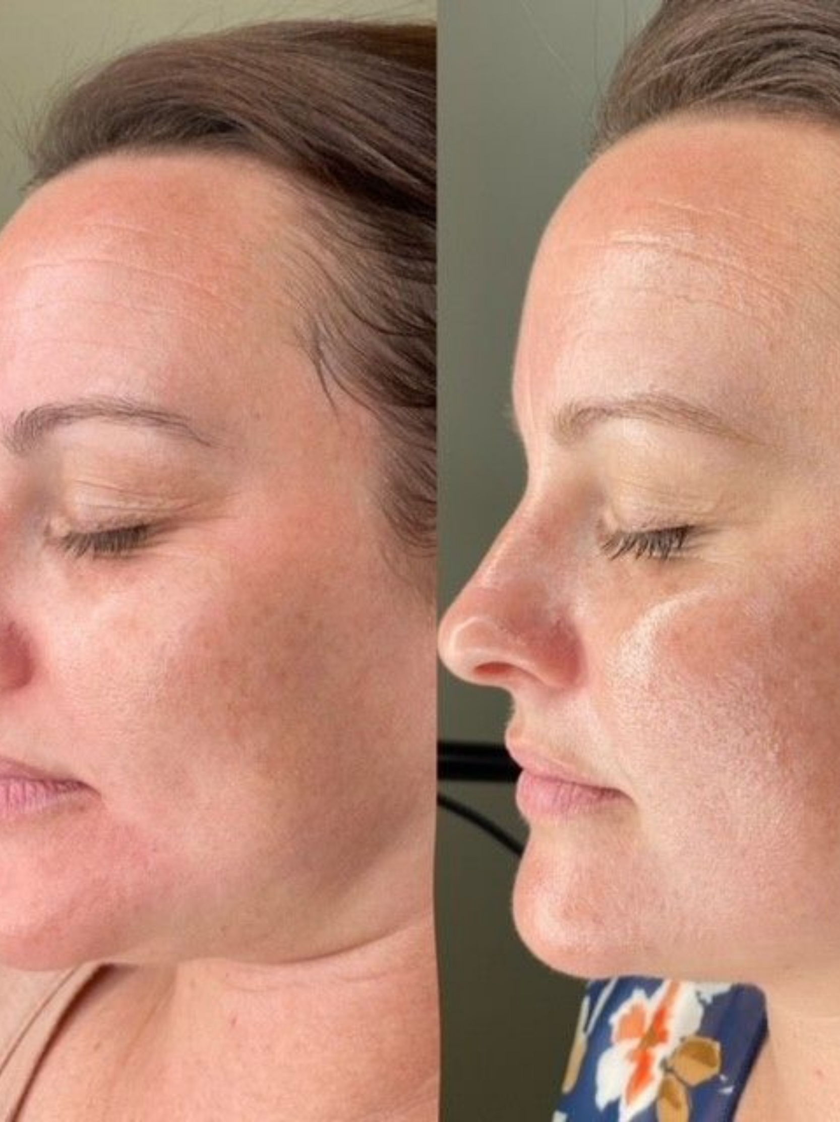 Antioxidant Booster Serum